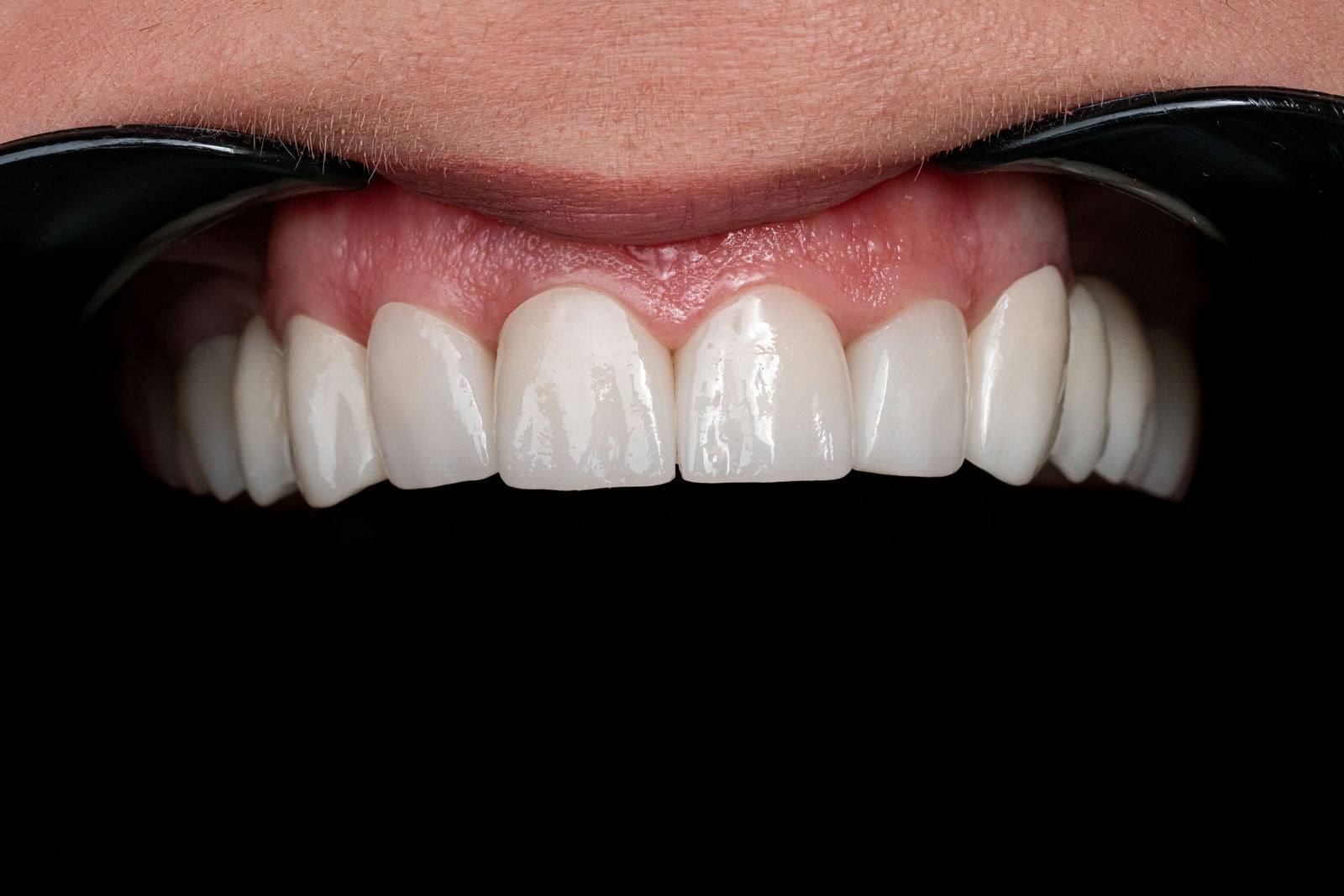 Fotografie Dentară